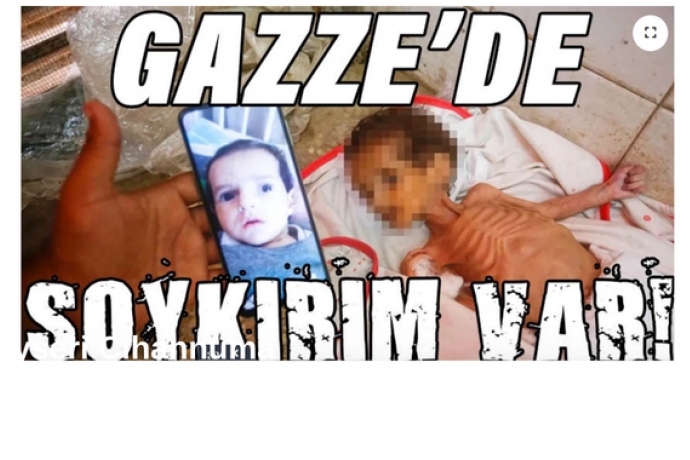 srail ablukas altndaki Gazze'de 3 aylk Curi de alktan can verdi